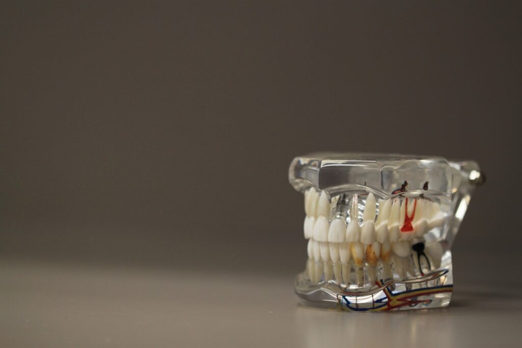 dentistry, dentals, teeth-668191.jpg